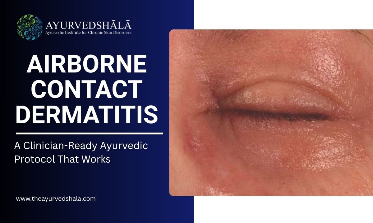 Airborne Contact Dermatitis