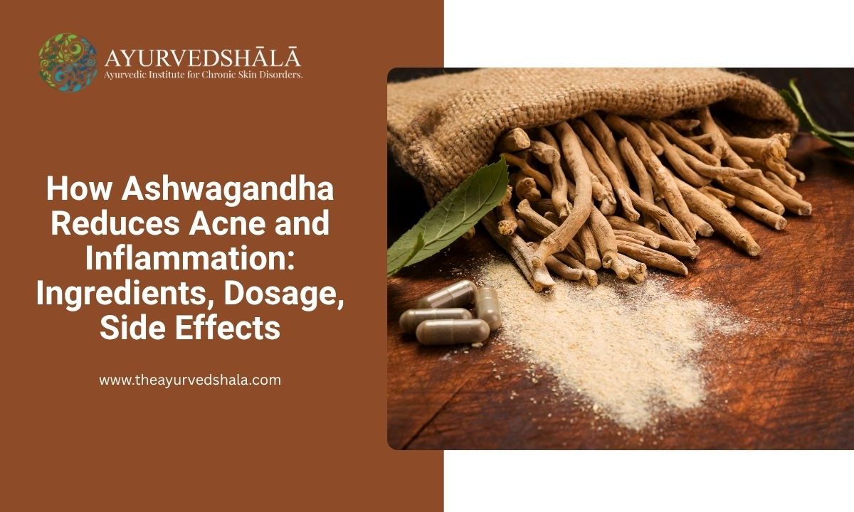 How Ashwagandha Reduces Acne and Inflammation Ingredients, Dosage, Side Effects