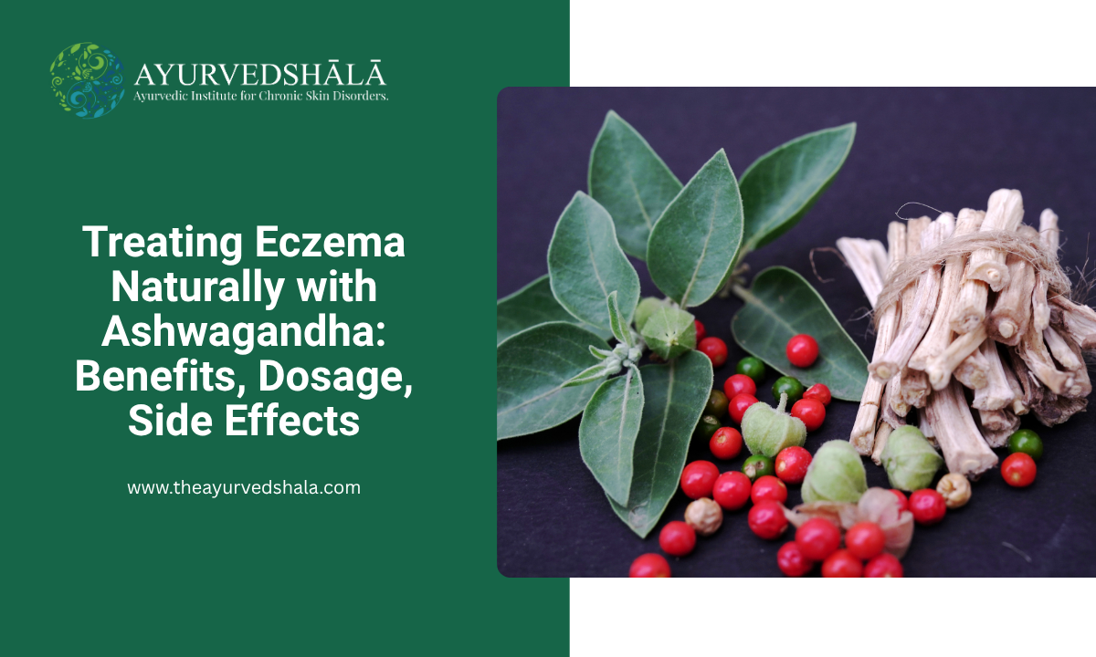 Treating Eczema Naturally with Ashwagandha Benefits, Dosage, Side Effects